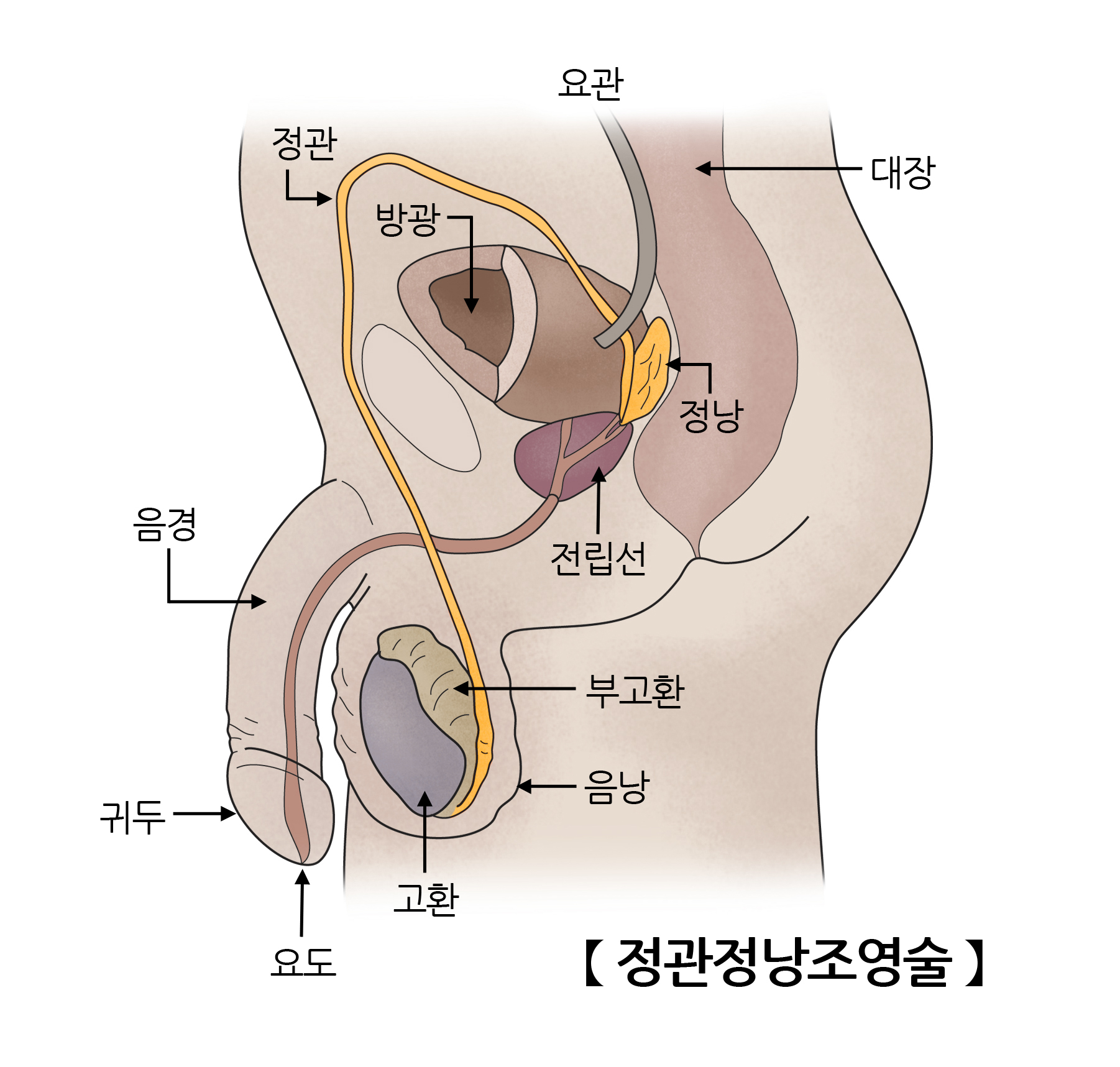 정관정낭조영술