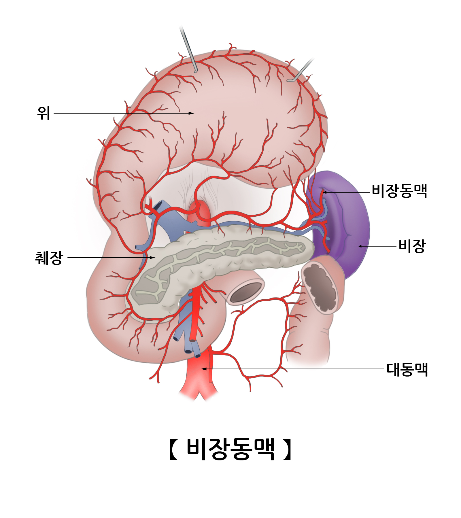 비장동맥
